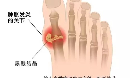俄罗斯黑鹅肝酱吃法视频-权威德国鹅肝酱平台,分享专业俄罗斯鹅肝罐头的吃法知识_俄罗斯黑鹅肝酱吃法网